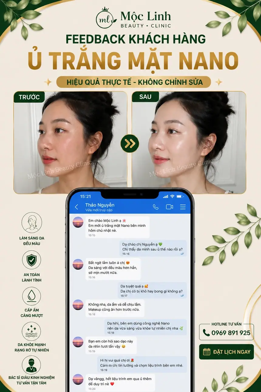 Ủ trắng mặt nano công nghệ cao tại Mộc Linh Hải Phòng