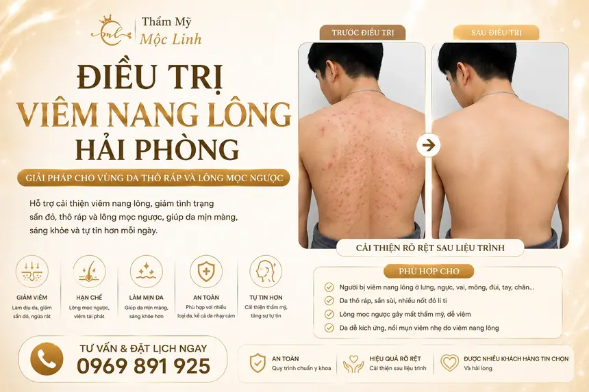 Điều Trị Viêm Nang Lông