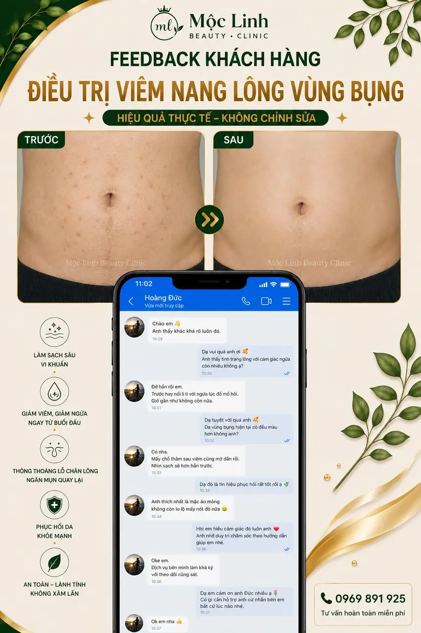 Chăm sóc da với điều trị viêm nang lông tại Hải Phòng