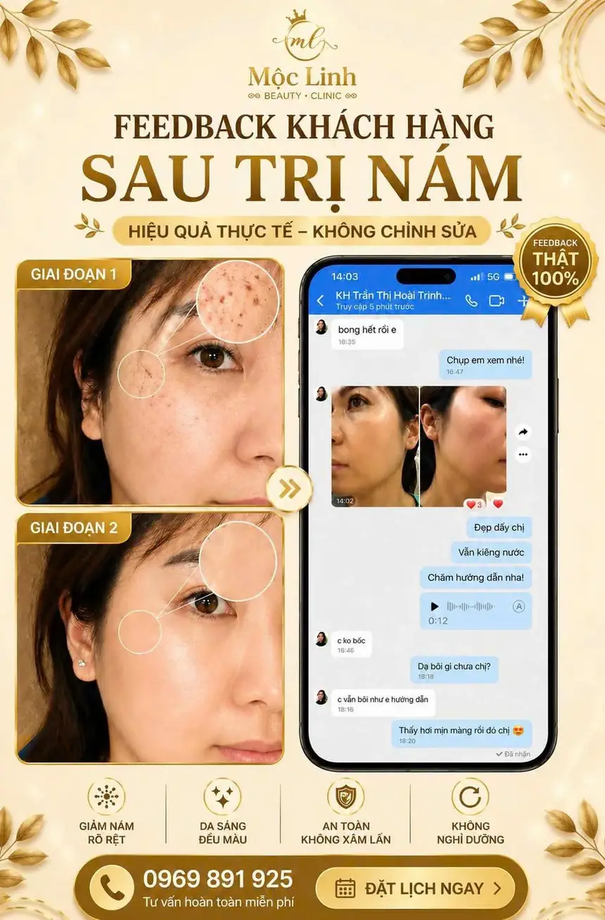 Feedback khách hàng sau điều trị nám thành công tại Hải Phòng