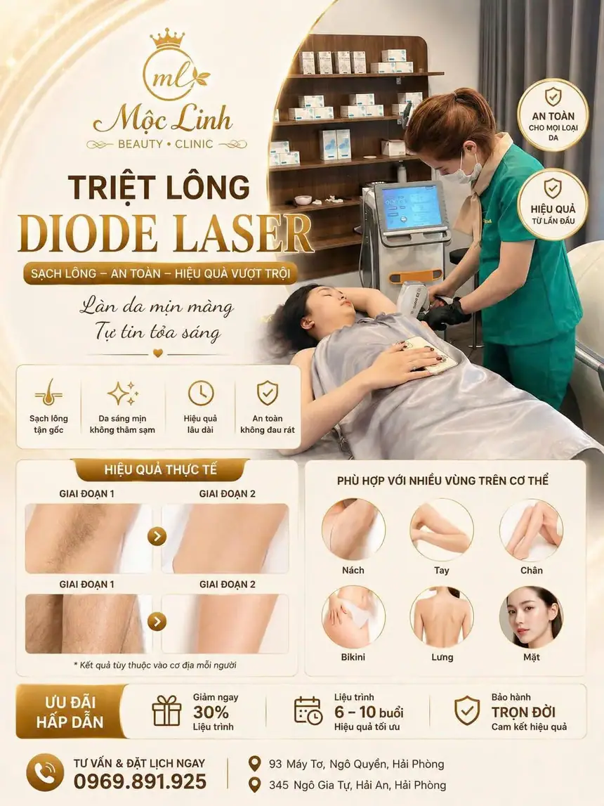 Triệt lông công nghệ Diode Laser tại Thẩm Mỹ Mộc Linh Hải Phòng giá hợp lý