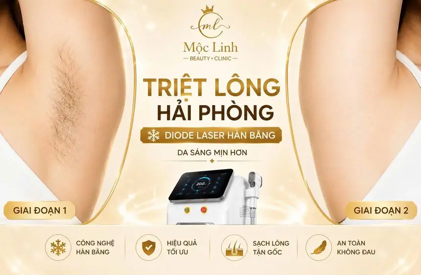 Triệt lông vùng bikini có an toàn không tại Hải Phòng